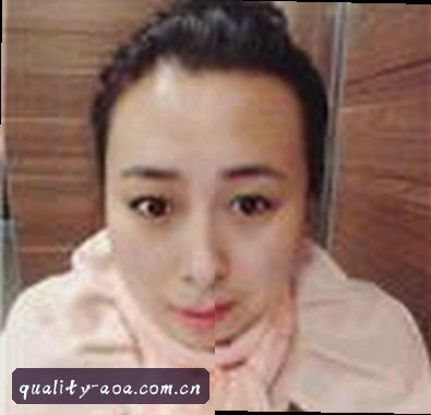 张鹏